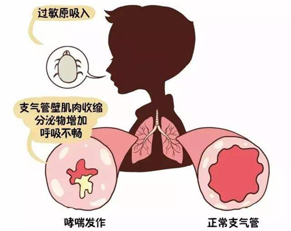 室内空气质量，过敏，装修污染，灰尘，螨虫，过敏，格瑞乐环保